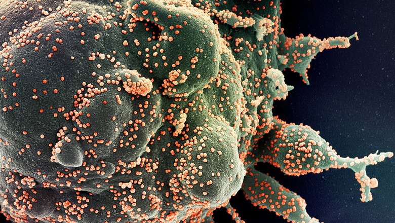 Британские ученые назвали новую версию происхождения коронавируса
