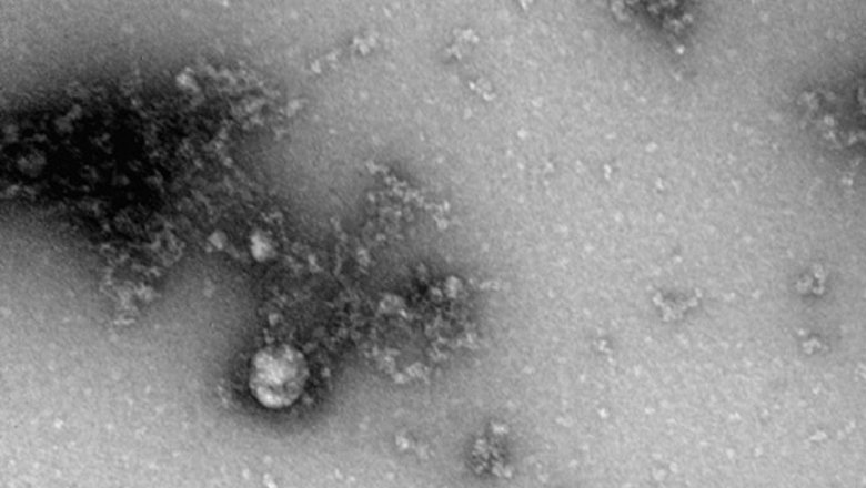 В Роспотребнадзоре сделали первое в мире фото «британского» штамма коронавируса