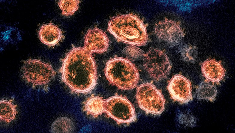 Шведские медики выяснили, что антитела к COVID-19 сохраняются в течение девяти месяцев