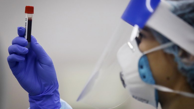 Ученые из США выявили альтернативный путь заражения коронавирусом