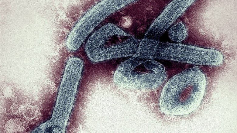 Похожий на Эболу. В Гвинее появился еще один смертельный вирус