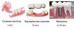 Зубные протезы: плюсы, минусы и срок службы